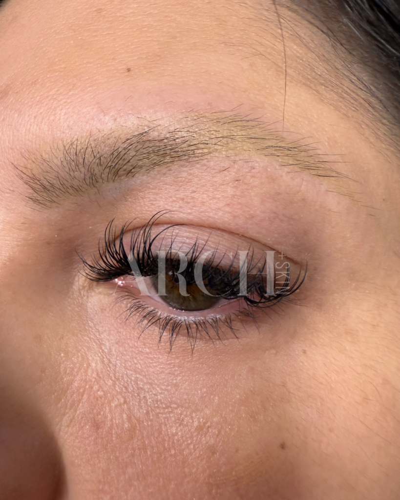 Before and after progression photos showing eyebrow density improvement over 6-month Revived Arch series in Dallas - sparse overplucked 90s brows showing fuller appearance after collagen induction therapy and LED treatment
