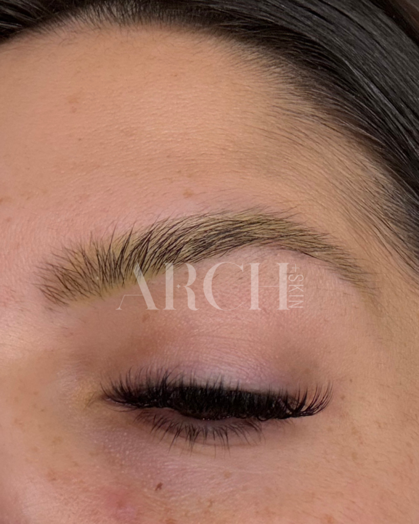 Before and after progression photos showing eyebrow density improvement over 6-month Revived Arch series in Dallas - sparse overplucked 90s brows showing fuller appearance after collagen induction therapy and LED treatment