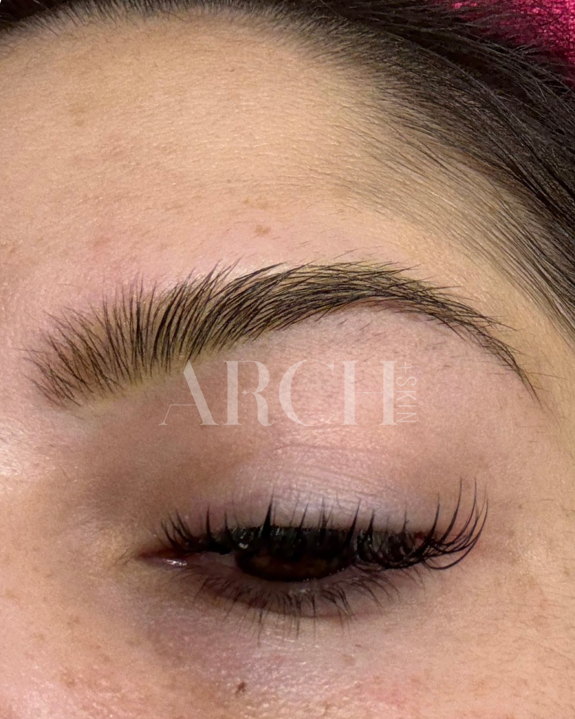 Before and after progression photos showing eyebrow density improvement over 6-month Revived Arch series in Dallas - sparse overplucked 90s brows showing fuller appearance after collagen induction therapy and LED treatment