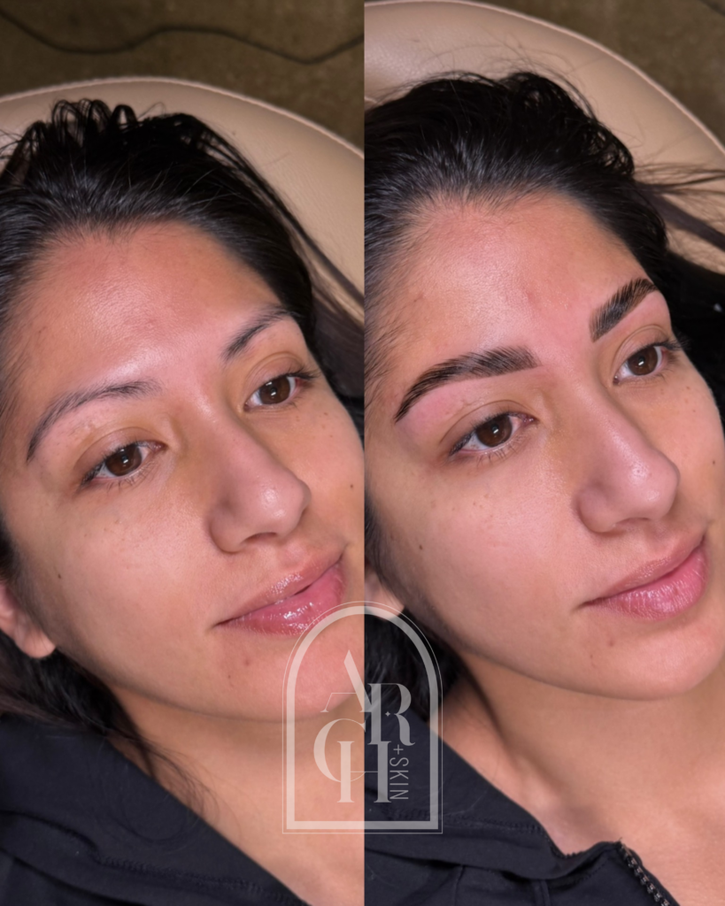 brow lamination before and after Dallas Texas