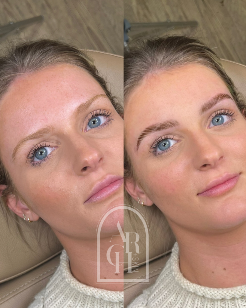 brow lamination before and after Dallas Texas