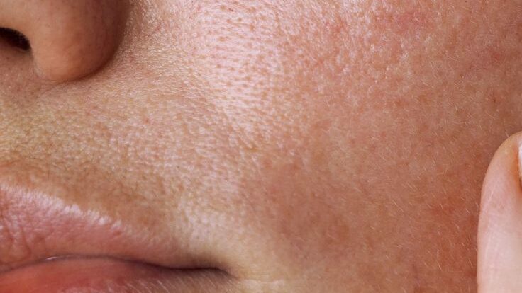 barrier-first skincare Dallas Arch + Skin sensitive skin rosacea