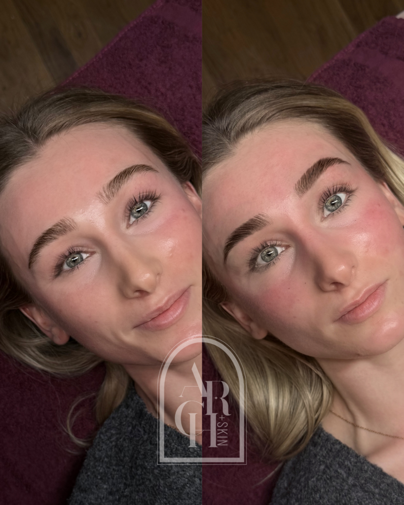 brow lamination before and after Dallas Texas