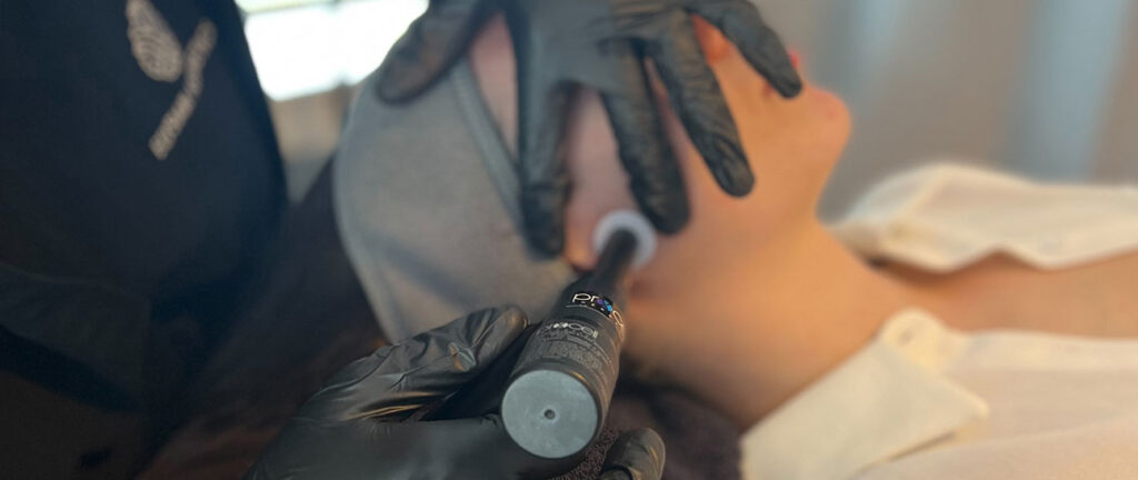 microchanneling vs microneedling Dallas Procell Arch + Skin